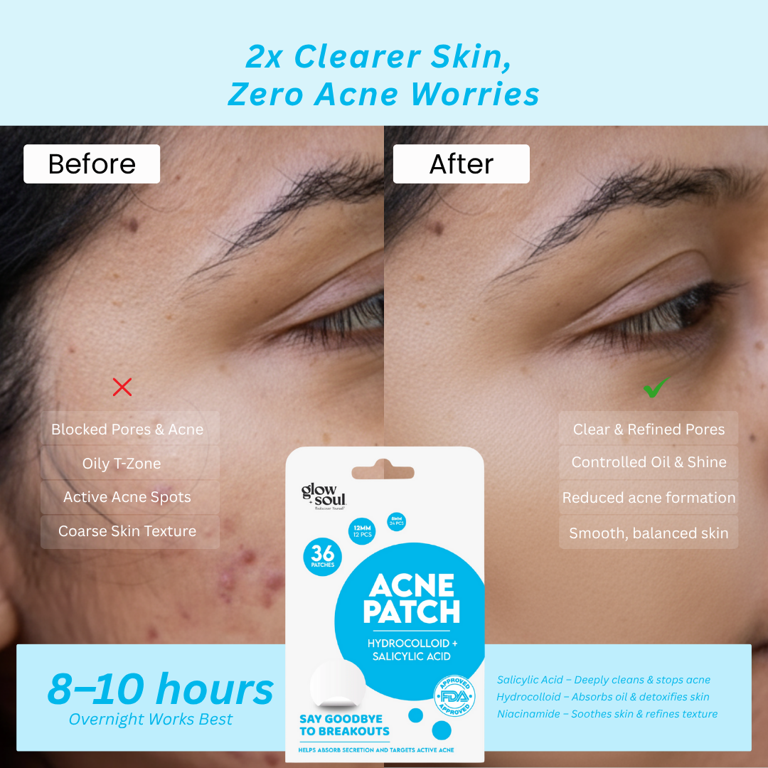 Regular Acne Patches  With Hydrocolloid + Salicylic Acid (36 Patches)